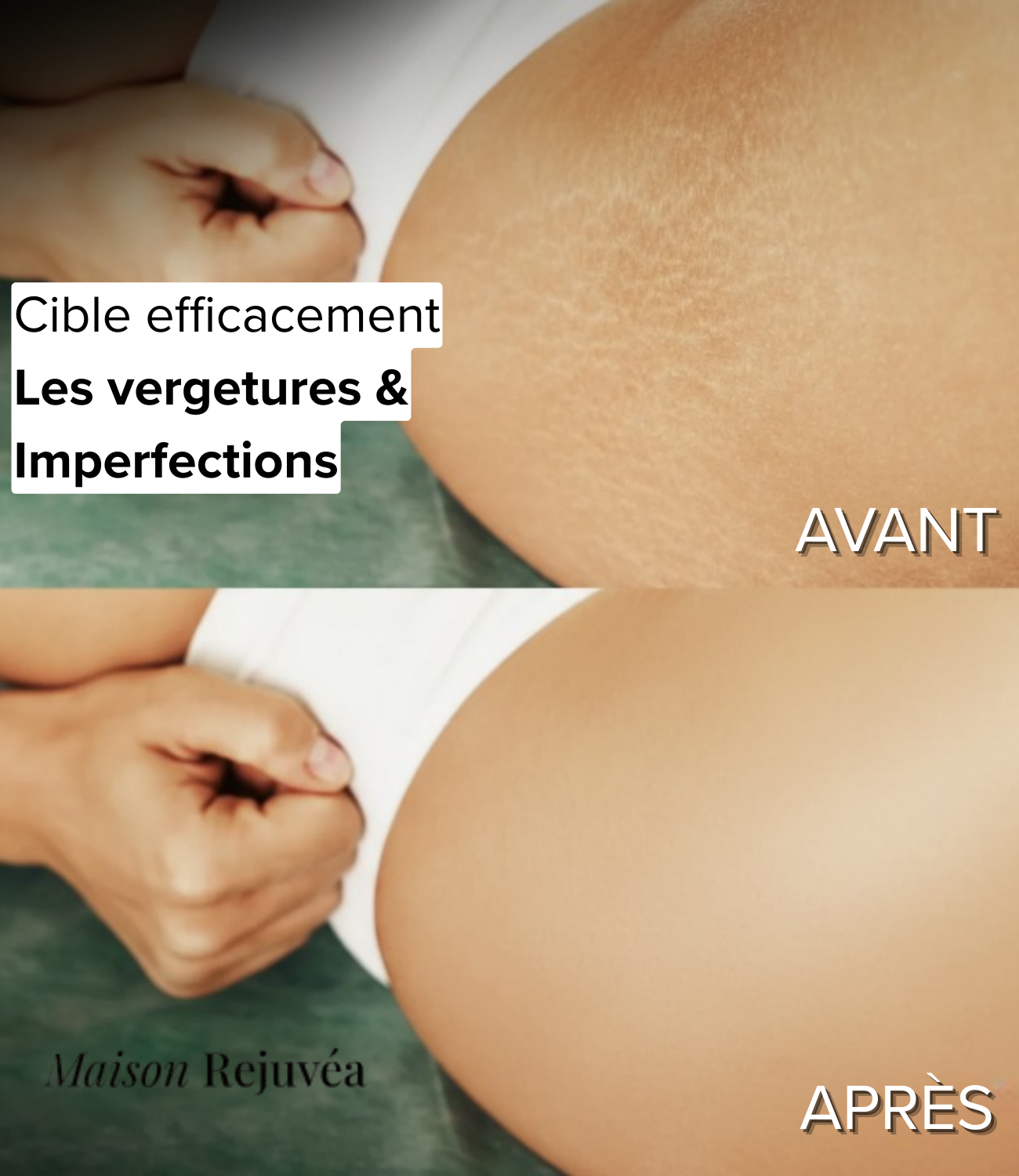 Maison Rejuvéa - Huile corporelle Rajeunissante