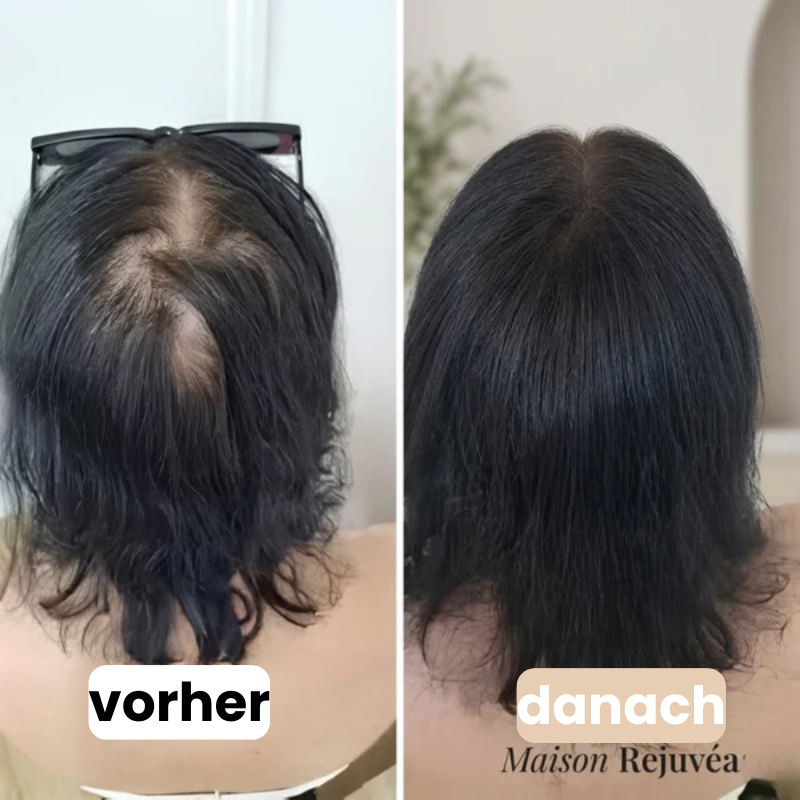 Haar-Roll-on-Serum
