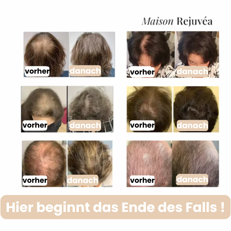 Haar-Roll-on-Serum