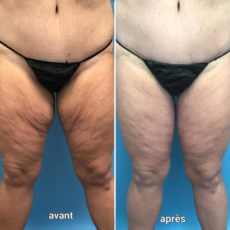 Maison Rejuvéa - Huile corporelle Rajeunissante