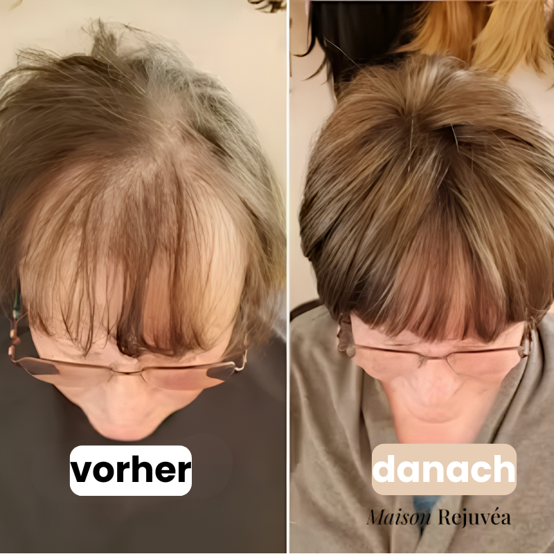 Haar-Roll-on-Serum
